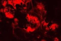 In Vitro Culture of Retinal Neurons: Lab Protocols