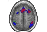 How Your First Language Rewires the Brain for Later Learning