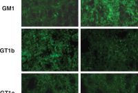 How to Protect the Brain from Parkinson’s Disease