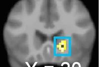 Training Teens’ Brains to Ignore Thin Models Cuts Eating Issues
