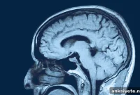 Reduced Gray Matter in Teens Linked to Behavioral Problems
