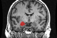 Train Your Brain to Manage Negative Emotions
