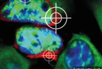 Why Do Neurons Die? Causes and Mechanisms