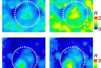 Scientists Identify New Factor Driving Parkinson’s Disease