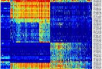 Novel Test Predicts Brain Tumor Aggressiveness