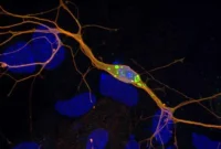 New Parkinson’s Disease Model Accelerates Drug Development