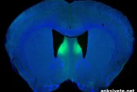 Study Pinpoints Brain Circuit That Sparks Rage