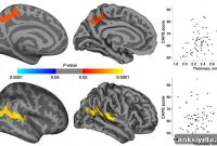 PTSD Neuroimaging Reveals Brain Changes in Earthquake Survivors