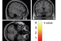 Molecular Basis of Higher Brain Functions and Neuropsychiatry
