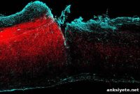 Promising Treatment Strategy for Central Nervous System Injuries