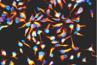 How Congenital Viral Infections Impact Fetal Brain Development