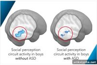 New Test Detects Autism Traits in Boys