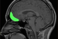 New Study Finds Small Brain Area Controls Everyday Decisions