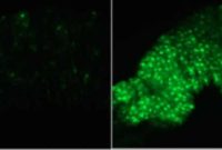 How Fasting Triggers a Genetic Switch to Curb Inflammation
