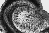 Hippocampal Neurogenesis Could Prevent Memory Loss
