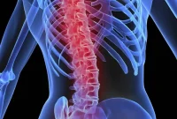 How Stroke Damages the Blood-Spinal Cord Barrier