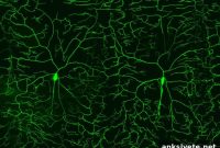 Study Reveals 36 Genes Linked to Pain and Nerve Sensitivity