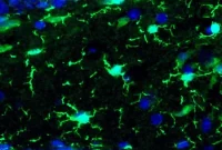 Fetal Immune Dysfunction Linked to Neurodevelopmental Disorders