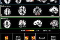 Methylene Blue May Boost Short-Term Memory