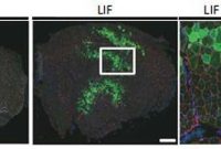 Grow and Transplant Muscle Stem Cells to Treat Muscular Dystrophy
