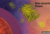 Cannabinoids May Reduce Alzheimer’s Proteins in Brain Cells
