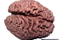 New Model Explains How Alzheimer’s Causes Dementia