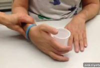 Repeated Stimulation Therapy Restores Movement After Paralysis