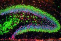 ALS Gene Active in Newly Identified Brain Regions