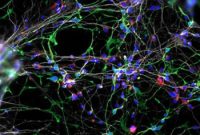 Williams Syndrome Model Sheds Light on the Social Brain