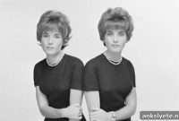 Twin Study Reveals How Genes Shape the Human Brain