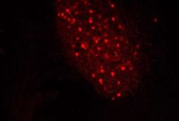 Mouse Study Finds Drug Target for Social Interaction in Autism