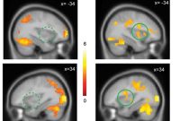 Perceived Nicotine Levels Fuel Cravings and Brain Activity