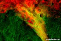 Study: New Brain Circuits Linked to Emotional Decision Making