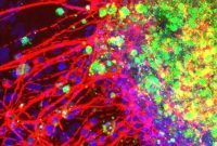 Zika Targets Neural Cells That Shape the Skull