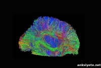 Does Brain Size Predict Intelligence and Cognitive Ability?