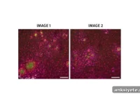Gene Therapy Shows Promise for Alzheimer’s in Mice