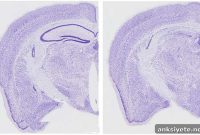 A Hidden Cause of Memory Loss in Neurodegenerative Disease