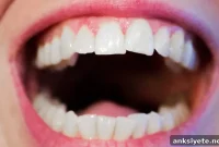 Oral Nitrate Reducing Bacteria Linked to Migraines