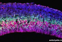 Epigenetics and Neural Cell Death: Mechanisms and Implications