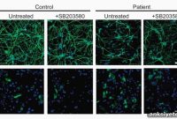 Schizophrenia-Derived Stem Cells Fail to Become Neurons
