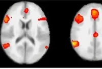 Brain Scans Detect Lies More Accurately Than Polygraphs