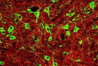 Stress Increases Alcohol Consumption in Rats, Study Finds