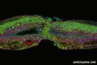 Scientists Identify Protein That Promotes Spinal Cord Repair