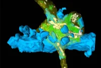 Hippocampal Hyperactivity and Full Neural Burst Mechanisms