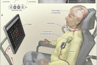 Brain Implant Lets Locked-In ALS Patient Control Speech Computer