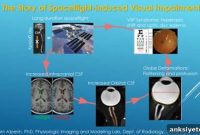 Study Identifies Microgravity as Cause of Astronaut Vision Loss
