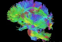 High School Football Head Impacts Linked to Brain Changes