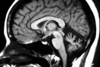 Why Confident People Influence Us: Brain Science Explained