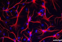 Toxic Brain Cells Could Underlie Neurodegenerative Diseases