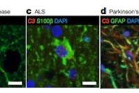 Jekyll and Hyde Brain Cells: How They Drive Injury and Disease